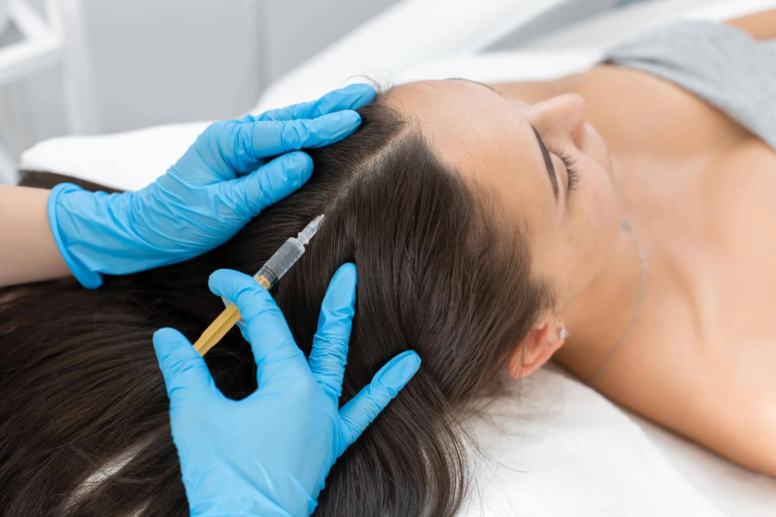 PRP therapy in Reading, MA at Posh Aesthetics and Wellness