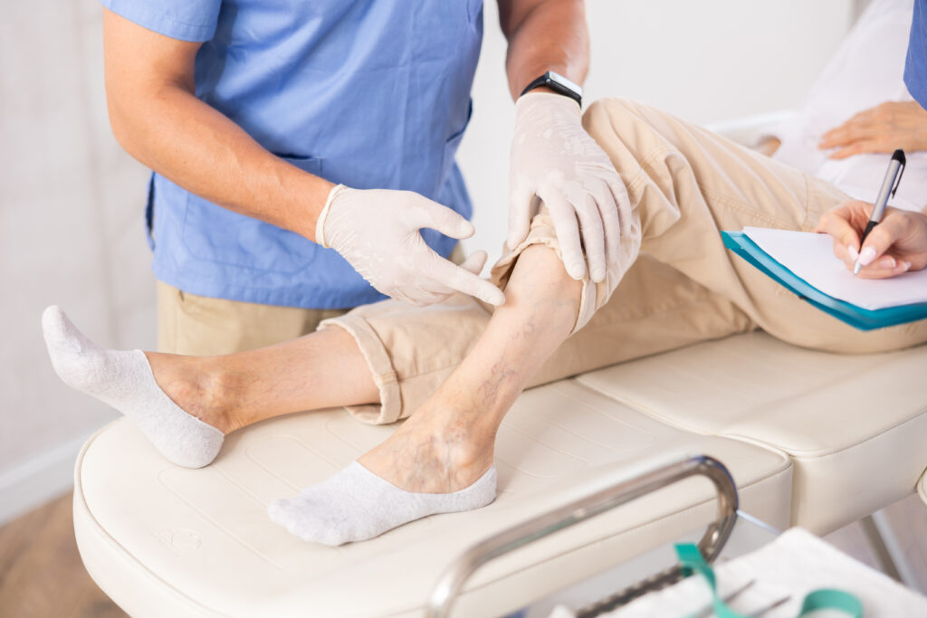 Sclerotherapy Treatment in Reading MA