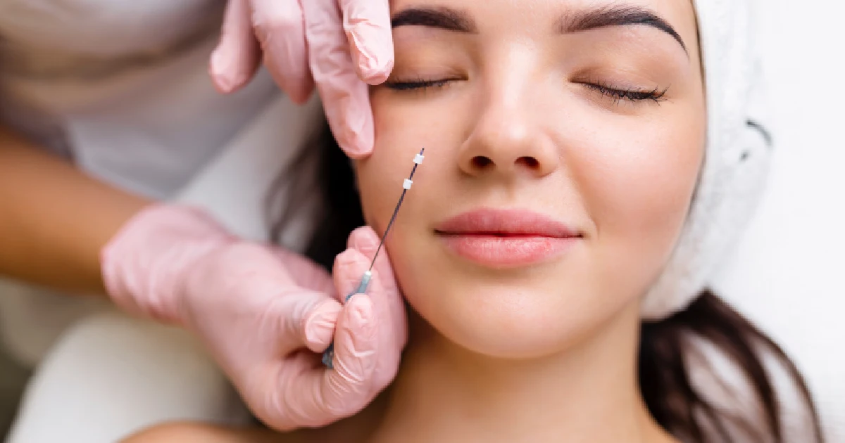 woman receiving a PDO thread lift procedure in Reading, MA