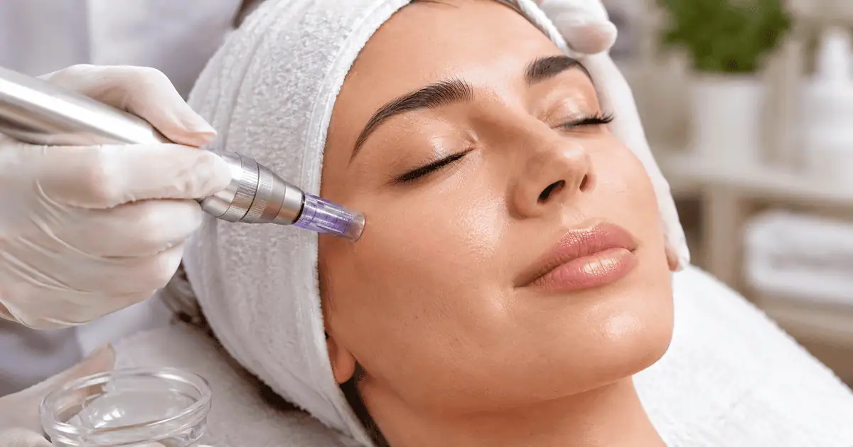 Microchanneling treatment improving skin texture and collagen production